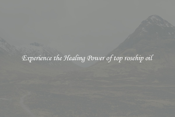 Experience the Healing Power of top rosehip oil 
